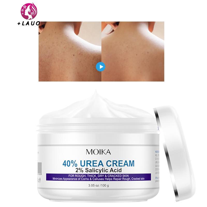 Springevenstar 40% Urea 2% Axit Salicylic Kem Dưỡng Ẩm Chăm Sóc Tay Kem Dưỡng Ẩm Chống Chèo Loại Bỏ Da Chết Chăm Sóc Da Springevenstar