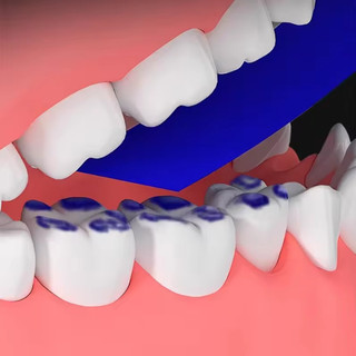 Nha Khoa Oclusal Giấy Dentista Xanh Đỏ Hai Mặt Cắn Dải Nha Sĩ Răng Miệng Chăm Sóc Răng Làm Trắng