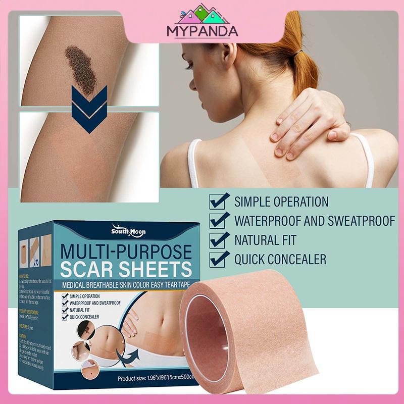 MYPANDA 1 Cuộn Màu Da Che Khuyết Điểm Hình Xăm Stiers Che Khuyết Điểm Hình Xăm Burn Scar Birthmark Miếng Dán Vô Hình Băng Chống Thấm Nước.