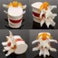 Mô hình thắt lưng CODECOVED, Mô hình 3D 1.5X Phóng to Mô hình bộ xương giải phẫu con người, Mô phỏng Công cụ giáo dục nén Trình diễn Công cụ giảng dạy thoát vị đĩa thắt lưng