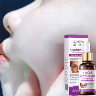 tinh chất cấy trắng da mặt 7 ngày sạch tàn nhang Serum trắng da và xóa tàn nhang 30ml Hiệu quả làm mờ thâm nám tàn nhan