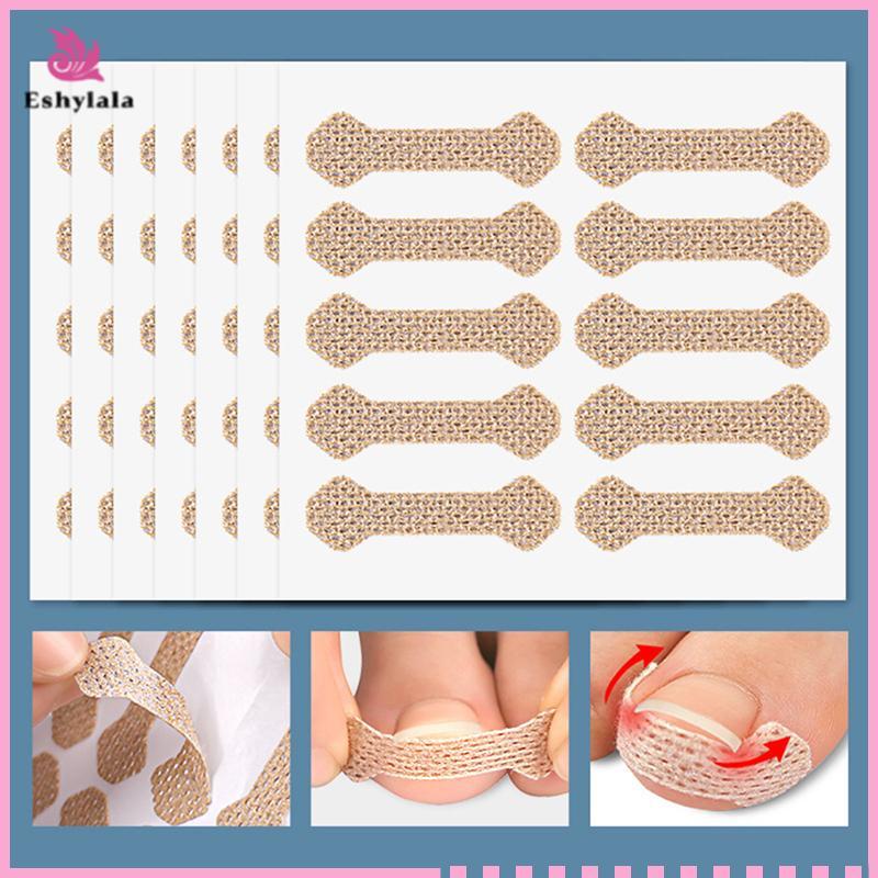 Eshylala 4 / 10 Tờ Dụng cụ làm móng chân mọc ngược Móng chân Stiers cho dụng cụ chỉnh sửa móng tay Paronychia Treatment Fixer Recover Bunion Feet Care [MỚI]