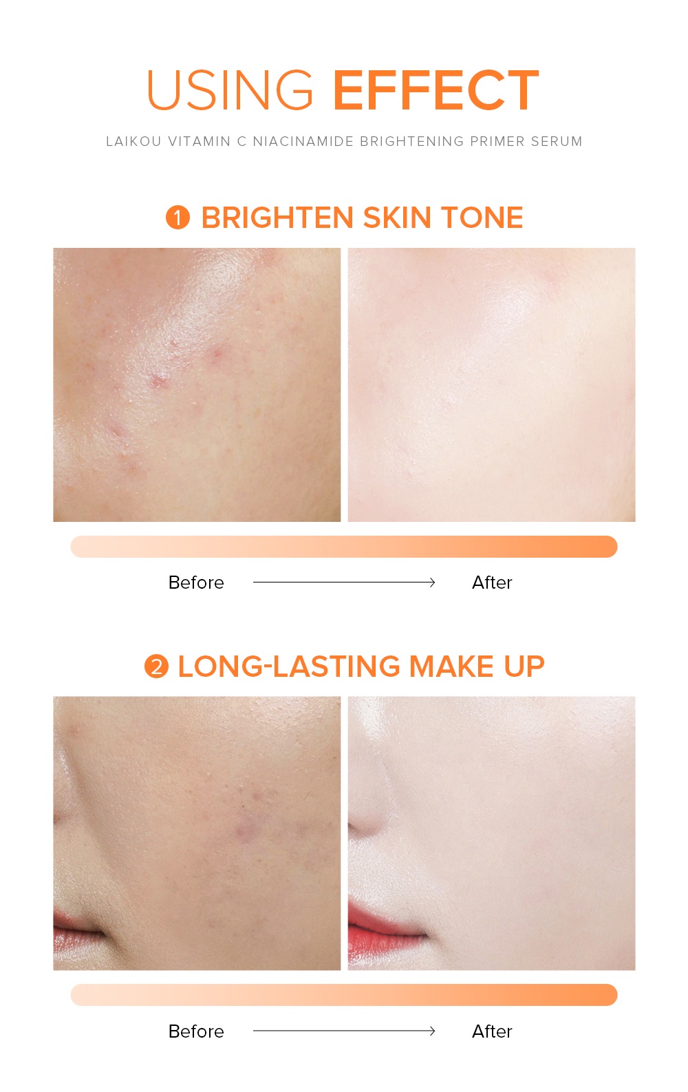 Mô tả Serum LAIKOU chứa vitamin C niacinamide làm sáng đều màu da 100ml - 8