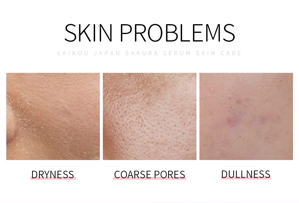 Mô tả Serum LAIKOU Nhật Bản 100ml giúp se khít lỗ chân lông và làm sáng tông da - 3