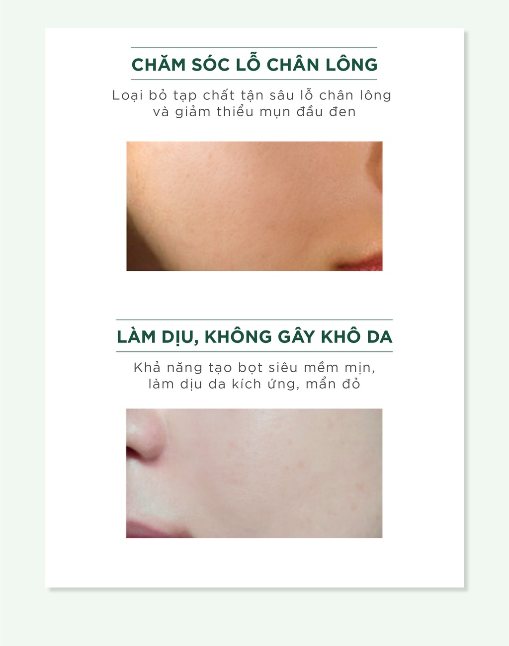 Mô tả Sữa rửa mặt ngừa mụn Caryophy Portulaca Cleansing Foam 150ml - 4
