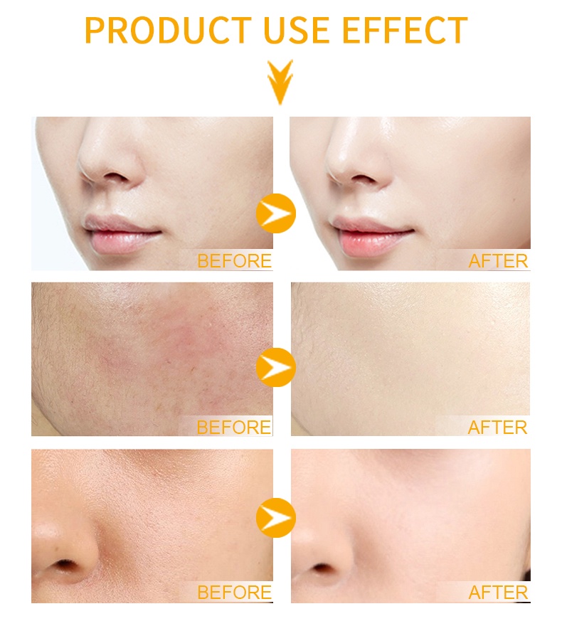 Mô tả Serum LIYAL'AN Vàng 24k Và Trứng Cá Muối Hữu Cơ Làm Trắng Da Chống Lão Hóa 30ml - 3