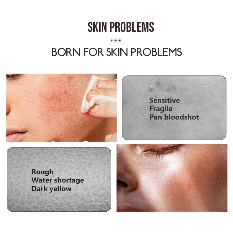 Mô tả Serum nghệ vitamin C LIYALAN dưỡng trắng da 30ml - 1