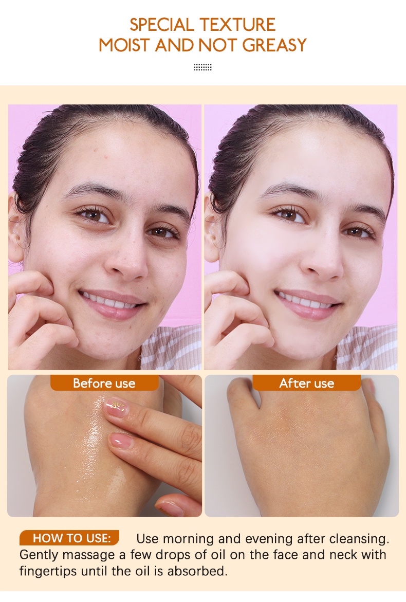 Mô tả Serum nghệ vitamin C LIYALAN dưỡng trắng da 30ml - 5