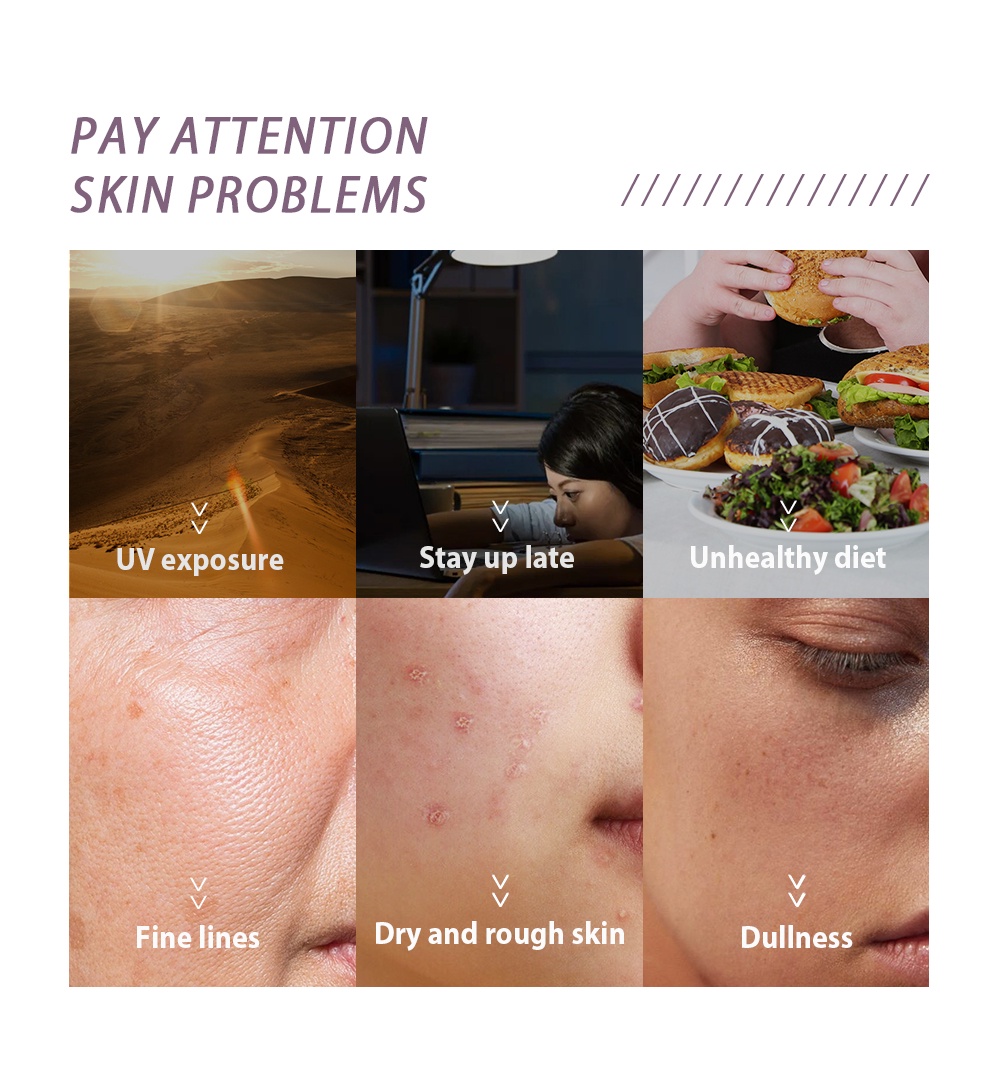 Mô tả Kem dưỡng ẩm LIYALAN 50g retinol hữu cơ tự nhiên chống lão hóa da cho nữ - 2