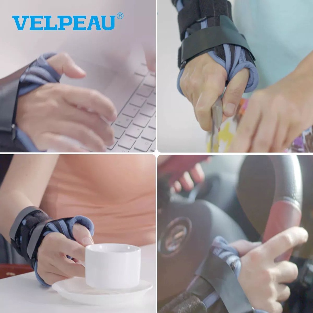 Mô tả Nẹp đeo cổ tay Velpeau với găng tay bảo vệ ngón cái cho bệnh hội chứng De Quervain, đau cổ tay, ổn định cho viêm gân, viêm khớp, trật khớp & gãy xương hỗ trợ cánh tay. - 1