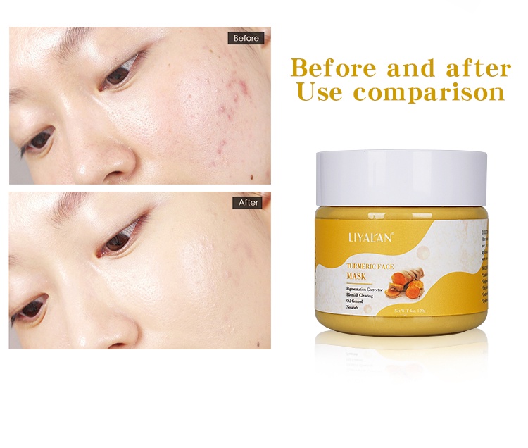 Mô tả LIYAL'AN Mặt Nạ Đất Sét Nghệ Thải Độc Dưỡng Sáng Da 120g - 4