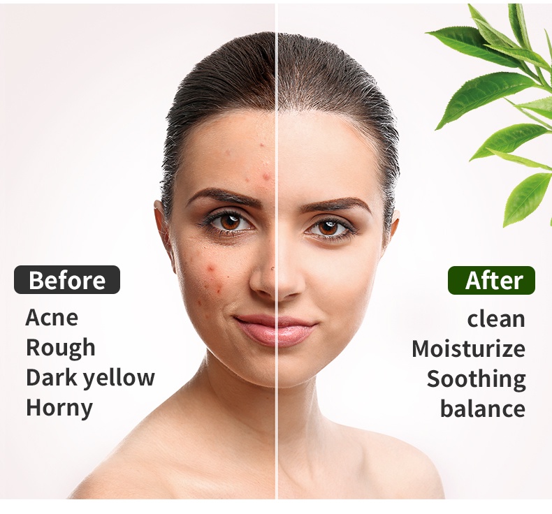 Mô tả Mặt nạ đất sét trà xanh LIYALAN thành phần tự nhiên dưỡng ẩm giải độc hiệu quả 150g - 5