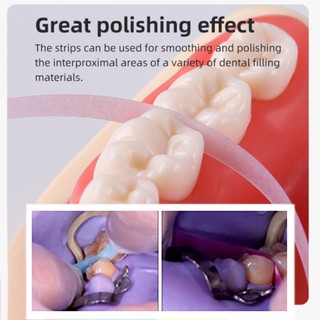 1 dải đánh bóng nha khoa cuộn - Dải hoàn thiện polyester nhựa tổng hợp