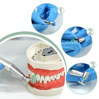 Đĩa đánh bóng nha khoa Vật tư tiêu hao Nha khoa Sọc Nồi hấp Composite Răng Dụng cụ nha khoa