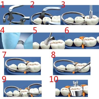 Nha Khoa Hình Thành Tấm Douban Khuôn Thép Không Gỉ Nha Khoa Phòng Thí Nghiệm Nha Khoa Ma Trận Nha Khoa Phần Đường Viền Kim Loại Ma Trận