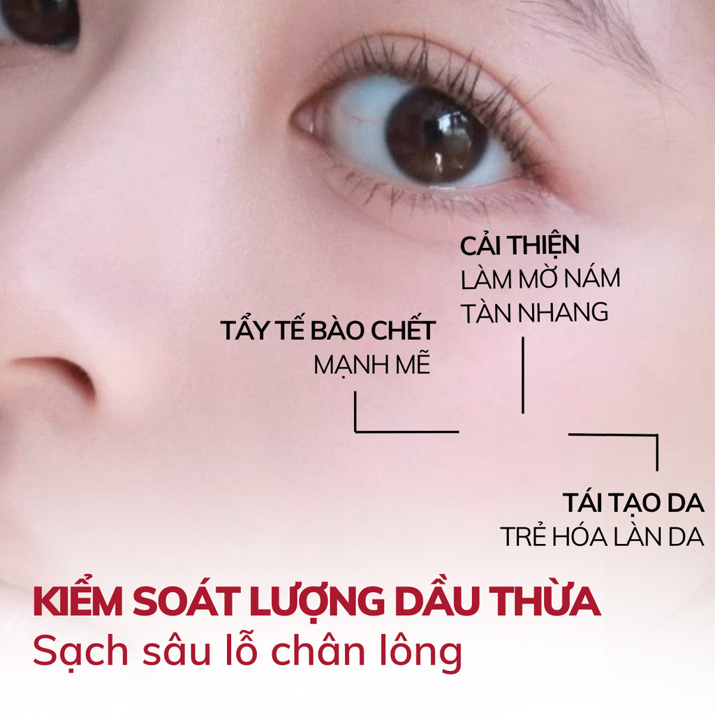 Mô tả Serum Compliment AHA 30% BHA 2%, Tẩy Tế Bào Chết Làm Sạch Sâu, Tái Tạo Da, Giảm Dầu Mụn 27ml - 5