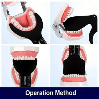 Nha Khoa Ảnh Nền Ban Miệng Chỉnh Nha Chụp Ảnh Tương Phản Miệng Cheek Tấm Đen Nền Hình Ảnh Tương Phản Ban