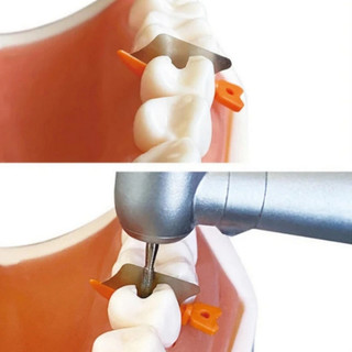 Bộ 50 Nha Khoa Prime Răng Nhựa Liên Cấp Nêm Bảo Vệ Với Ma Trận Thép Bảo Vệ Kim Loại