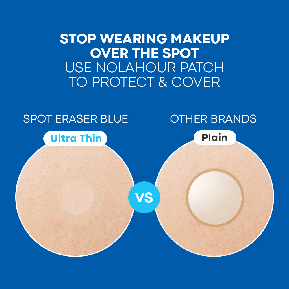 NOLAHOUR Spot Eraser Blue 63 Miếng Dán Mụn Mỏng Trong Suốt, Che Phủ & Bảo Vệ Mụn Có Mủ Hoặc Mụn Đã Vỡ