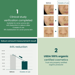 Tinh Dầu Tràm Trà Tea Tree Oil 100% Giảm Mụn Kháng Khuẩn Kiềm Dầu Nguyên Chất 10ml 62LAB