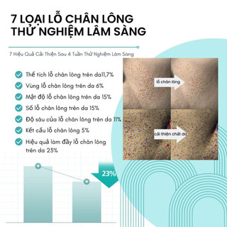 Serum Niacinamide 20% Thu Nhỏ Lỗ Chân Lông Kiềm Dầu Giảm Mụn Cho Da Dầu 40ml PORECENT