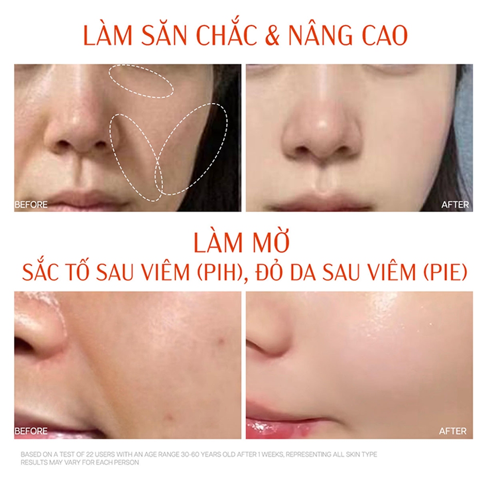 Ansology Super Bouncy Serum Vegen Collagen EGF FGF IGF 30ml