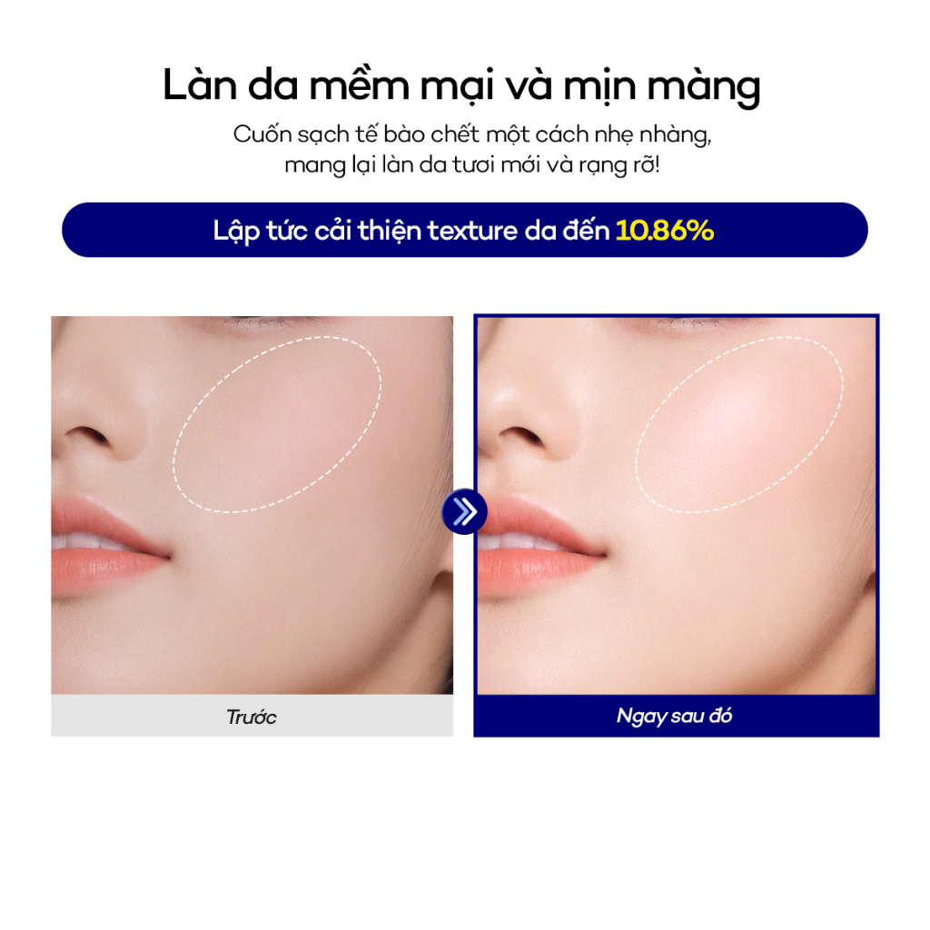 [DEWYTREE] Dầu Tẩy Trang Tẩy Sạch Makeup & Làm Sạch Sâu Lỗ Chân Lông Hi Amino All Cleansing Oil 200ml