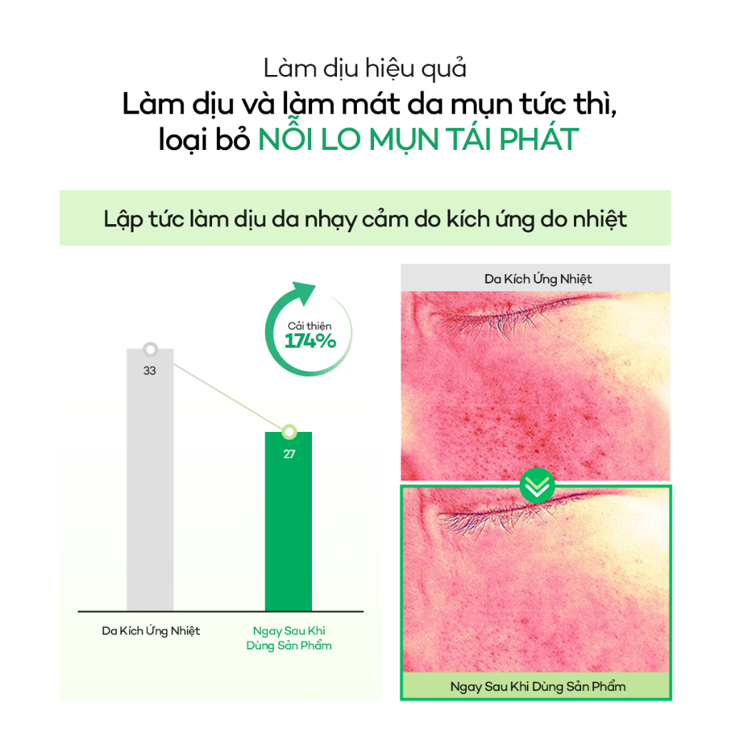 [DEWYTREE] Mặt Nạ Dưỡng Sáng Da Mụn Giảm Sưng Đỏ & Mờ Thâm Mụn AC Deep Blemish Calming Mask (10ea)