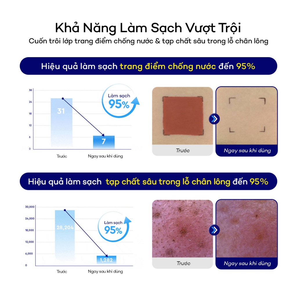 [DEWYTREE] Sáp Tẩy Trang Làm Sạch Sâu Lỗ Chân Lông & Giảm Mụn Đầu Đen Hi Amino All Cleansing Balm 90g