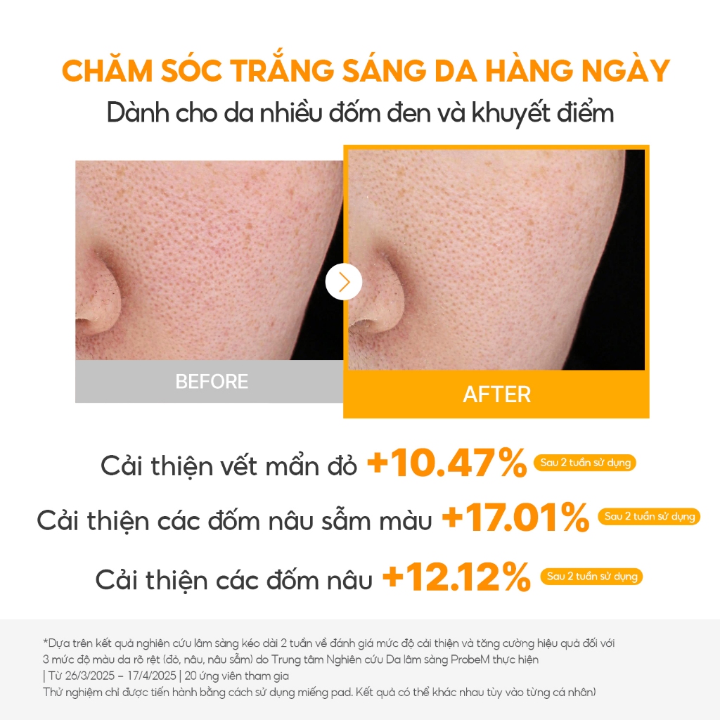 [Torriden Chính hãng] Spot Toning Pad Trắng sáng da CELLMAZING 70 miếng, Toner pad