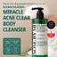 Sữa tắm giảm mụn AHA-BHA-PHA 30 Days Miracle Acne Clear Body Cleanser 400g
