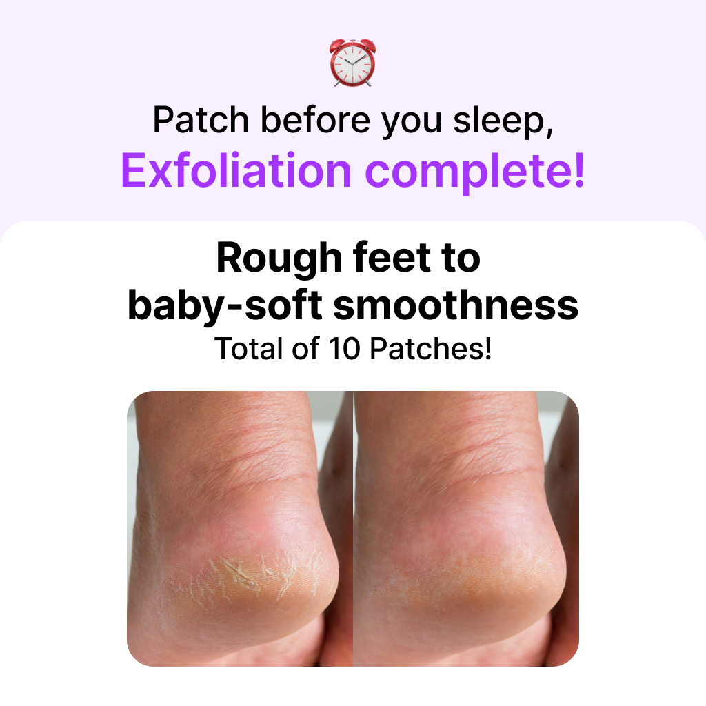 [MỚI] Miếng dán gót chân khi ngủ Bơ Hạt Mỡ [Siêu dưỡng ẩm, chân nắc nẻ, chăm sóc bàn chân]