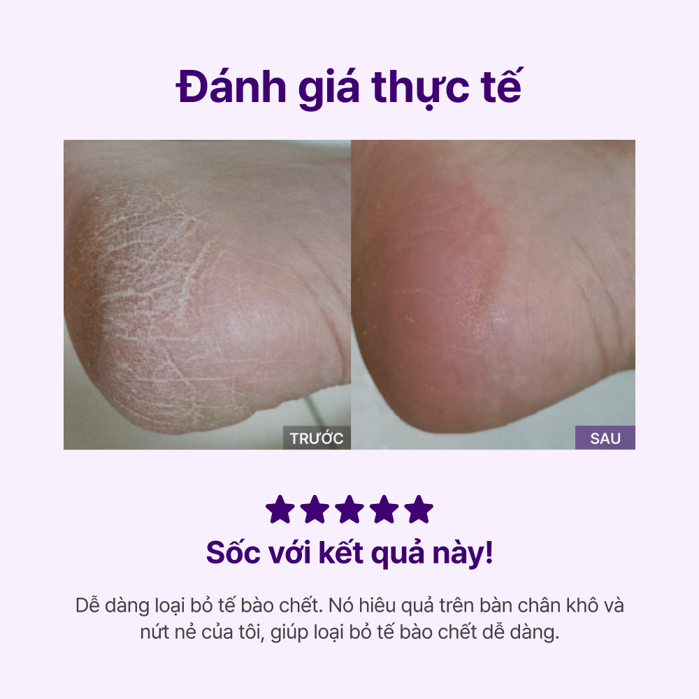 [SHOPEE SPECIAL] BEST COMBO Chăm Sóc Chân & Móng
