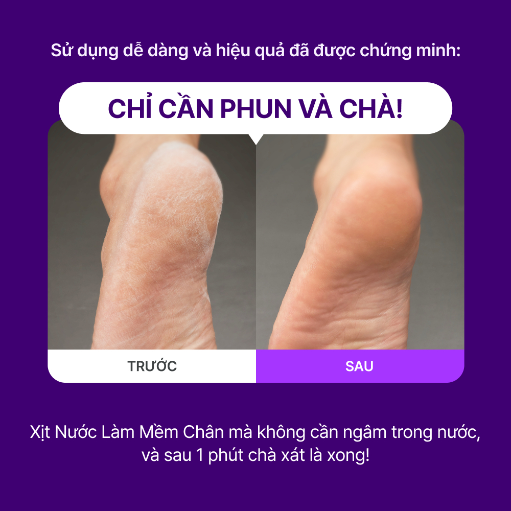 [SHOPEE SPECIAL] BEST COMBO Chăm Sóc Chân & Móng