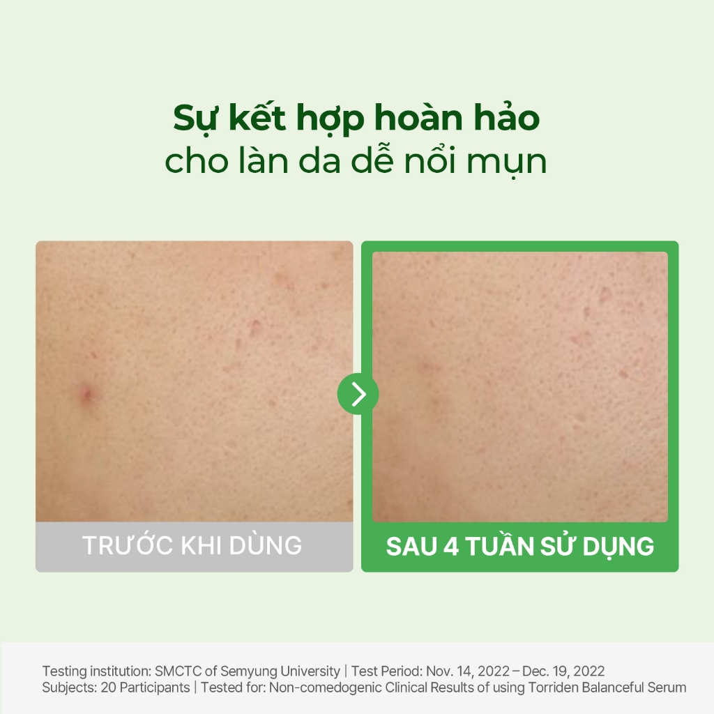[Torriden Chính hãng] [SET] Serum BALANCEFUL CICA, 50ml+50ml