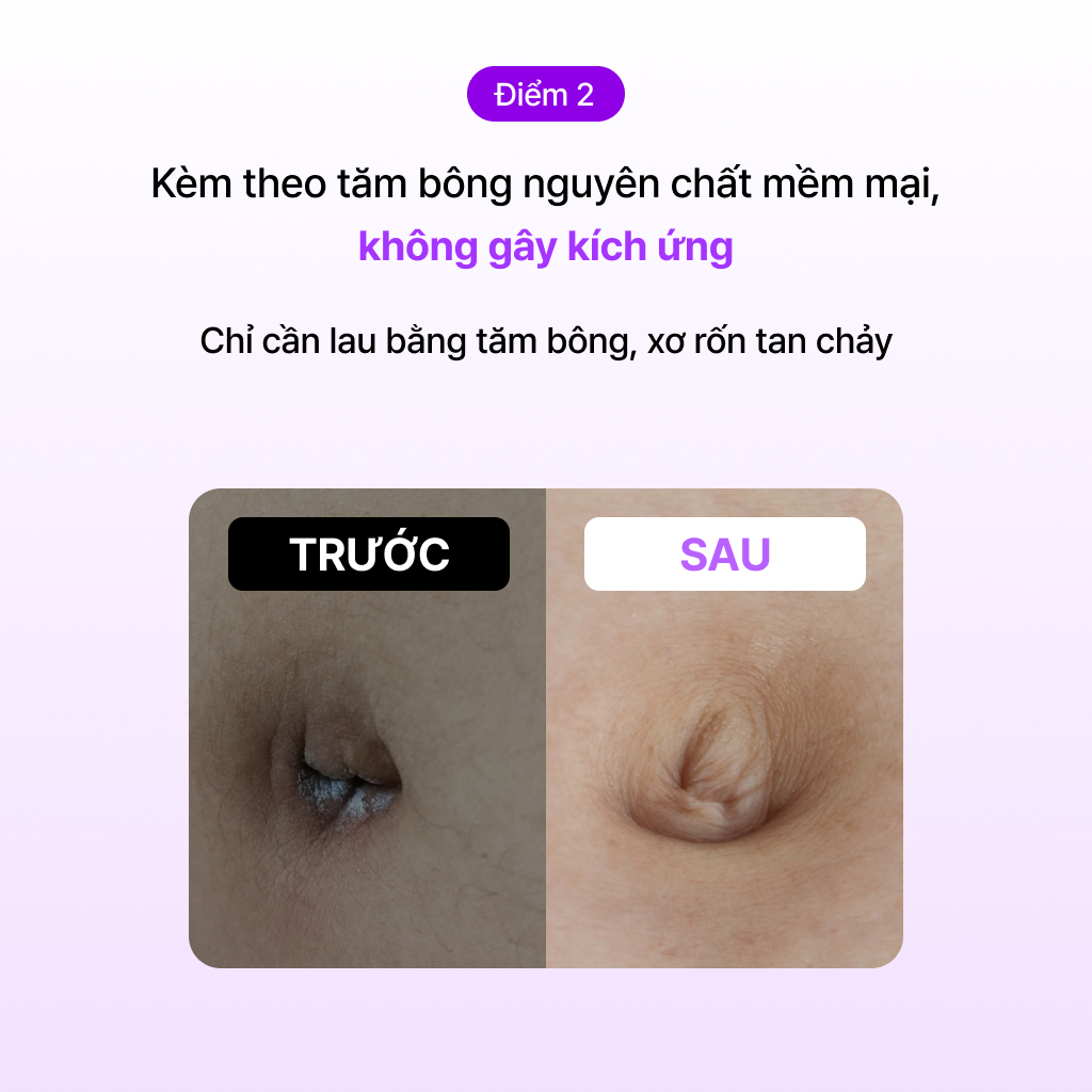 baren Bộ Sản Phẩm Làm Sạch Rốn Nhẹ Nhàng & Thuần Khiết [Dưỡng Ẩm Cực Tốt]