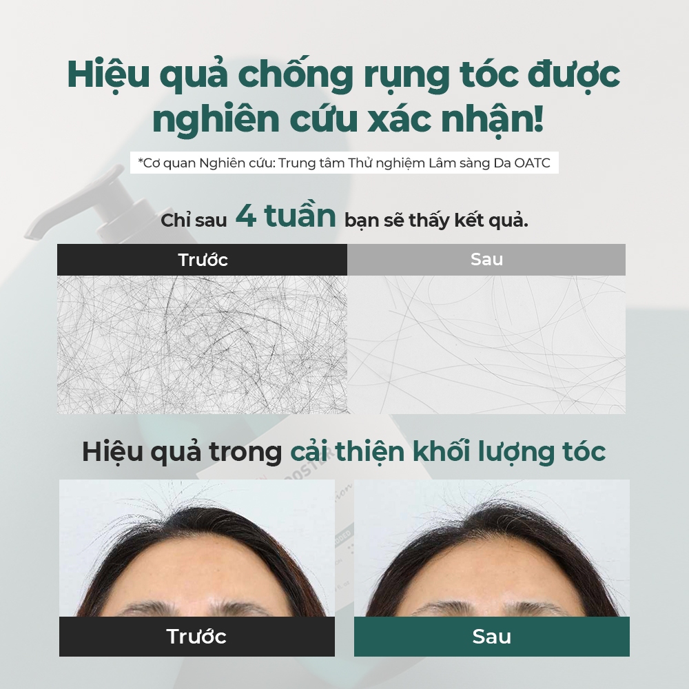 Ảnh Dầu gội Root Booster 500ml [Dầu gội chống rụng tóc số 1, 22 loại axit amin, 6 loại nguyên liệu tự nhiên] 4