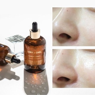 Tinh chất serum dưỡng da LORY & CHEL Glorious Essence 80g