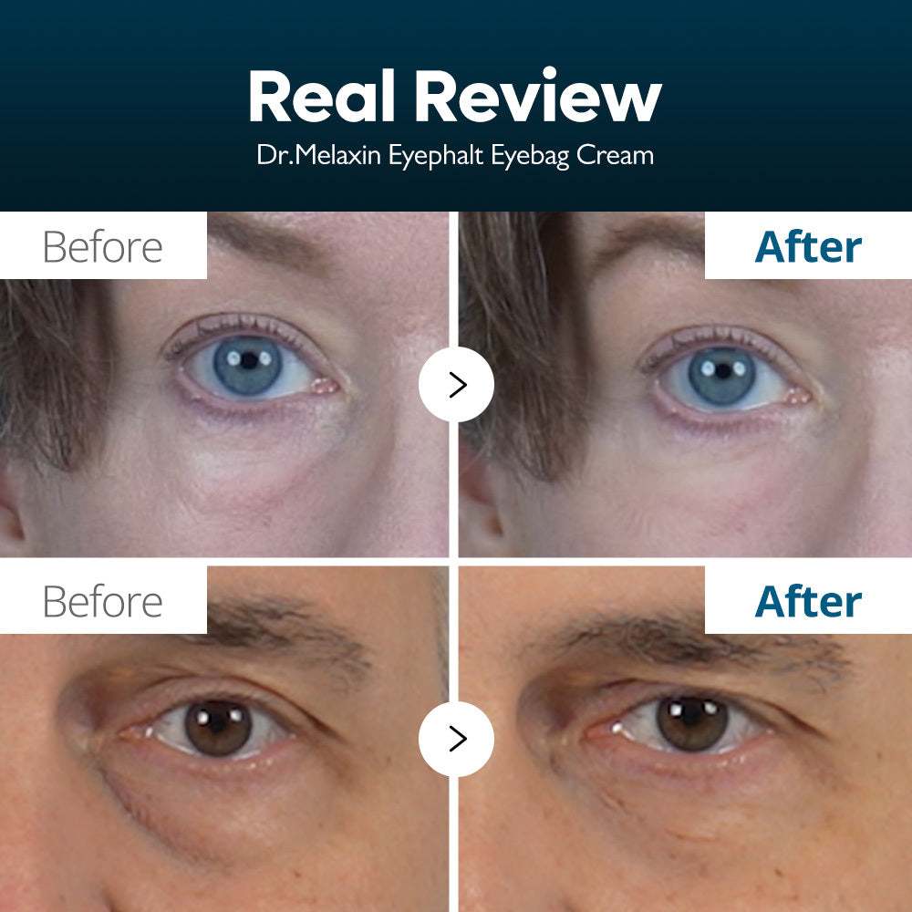 Kem dưỡng mắt Dr.Melaxin Eyephalt 10ml - Kem dưỡng mắt chống lão hóa cho túi mắt, bọng mắt, quầng thâm