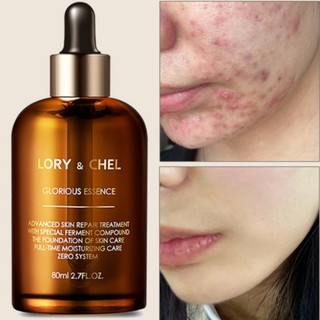 Tinh chất serum dưỡng da LORY & CHEL Glorious Essence 80g