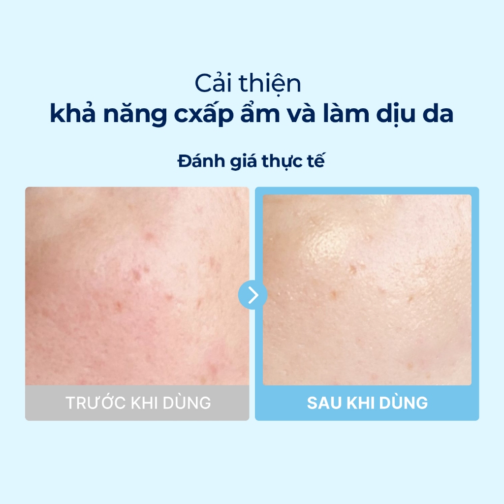 [ Torriden Live ] Pad đa năng DIVE IN chứa Hyaluronic Acid, 80 miếng, Toner Pad