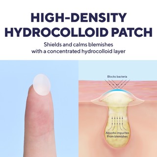 Miếng dán mụn caraseoul Overnight Spot Patches 102 miếng