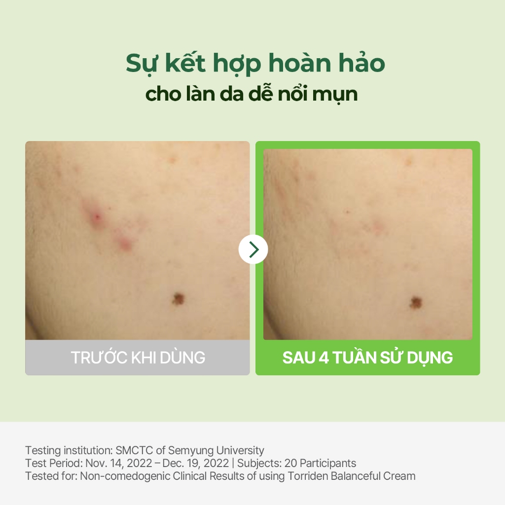 [ Torriden Live ] Kem dưỡng da BALANCEFUL CICA, 80ml, Cream