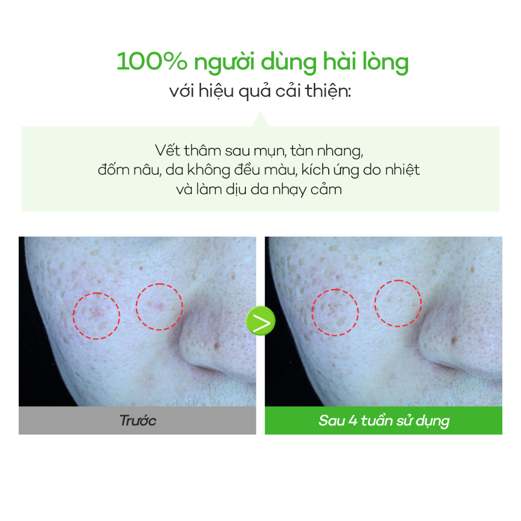 [DEWYTREE] Tinh Chất Dưỡng Sáng Da Mụn Mờ Thâm, Nám & Tàn Nhang AC Deep Blemish Calming Ampoule 60ml