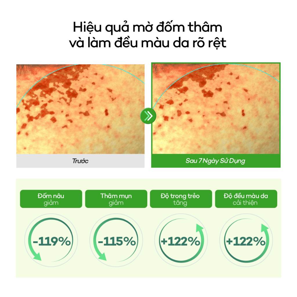 [DEWYTREE] Toner Pad Dưỡng Sáng Mờ Thâm & Làm Dịu Da AC Deep Blemish Green Calming Pad 80 Miếng