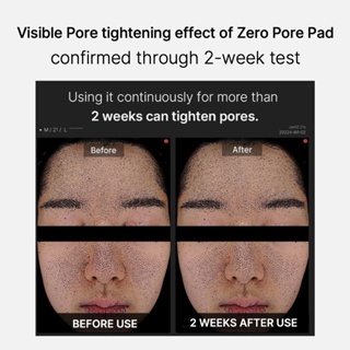 Medicube Zero Pore Pad 2.0 Phiên bản đôi - Bộ chăm sóc da tối thiểu lỗ chân lông - 70 miếng + Refill - Vẻ đẹp Hàn Quốc