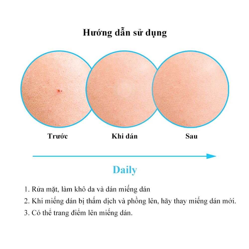 Miếng dán mụn NOLAHOUR, giai đoạn phục hồi da - Bước 2