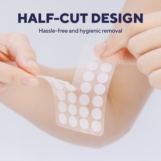 Miếng dán mụn caraseoul Overnight Spot Patches 102 miếng