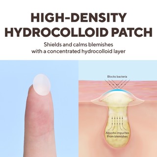 Miếng dán mụn caraseoul Overnight Spot Patches 52 miếng