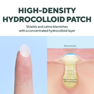 Miếng dán mụn caraseoul Overnight Spot Patches 74 miếng